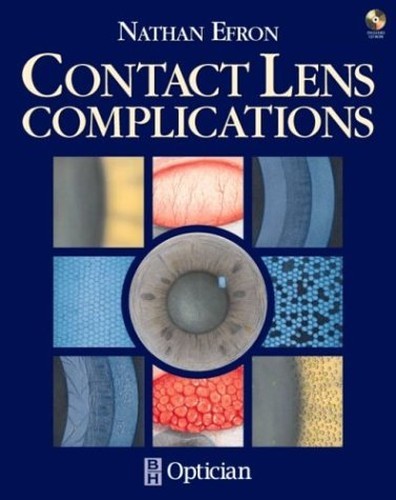 Contact lens complications - contact,