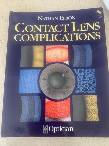 Contact lens complications - contact,