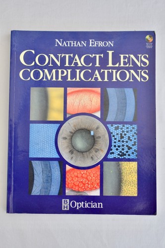 Contact lens complications - contact,