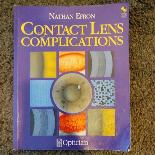 Contact lens complications - contact,