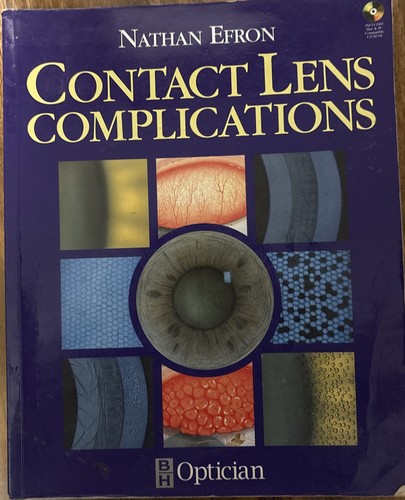 Contact lens complications - complications, by